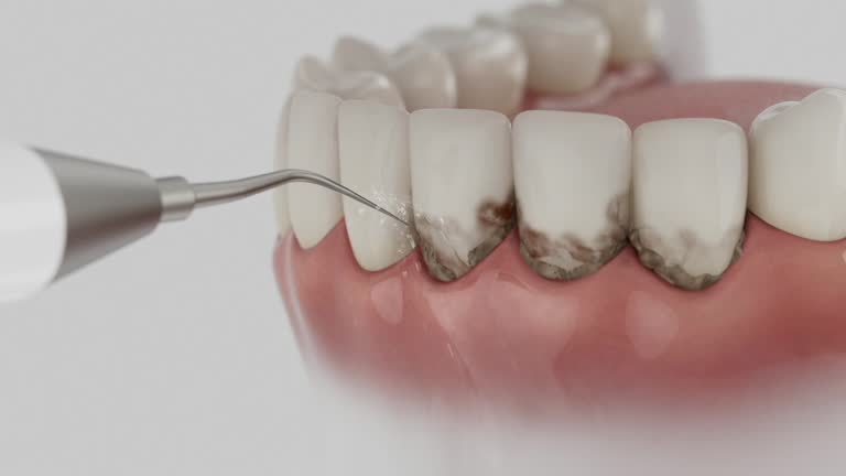 Trusted Tooth Extraction service in South Bay, FL - Dentist Open Now